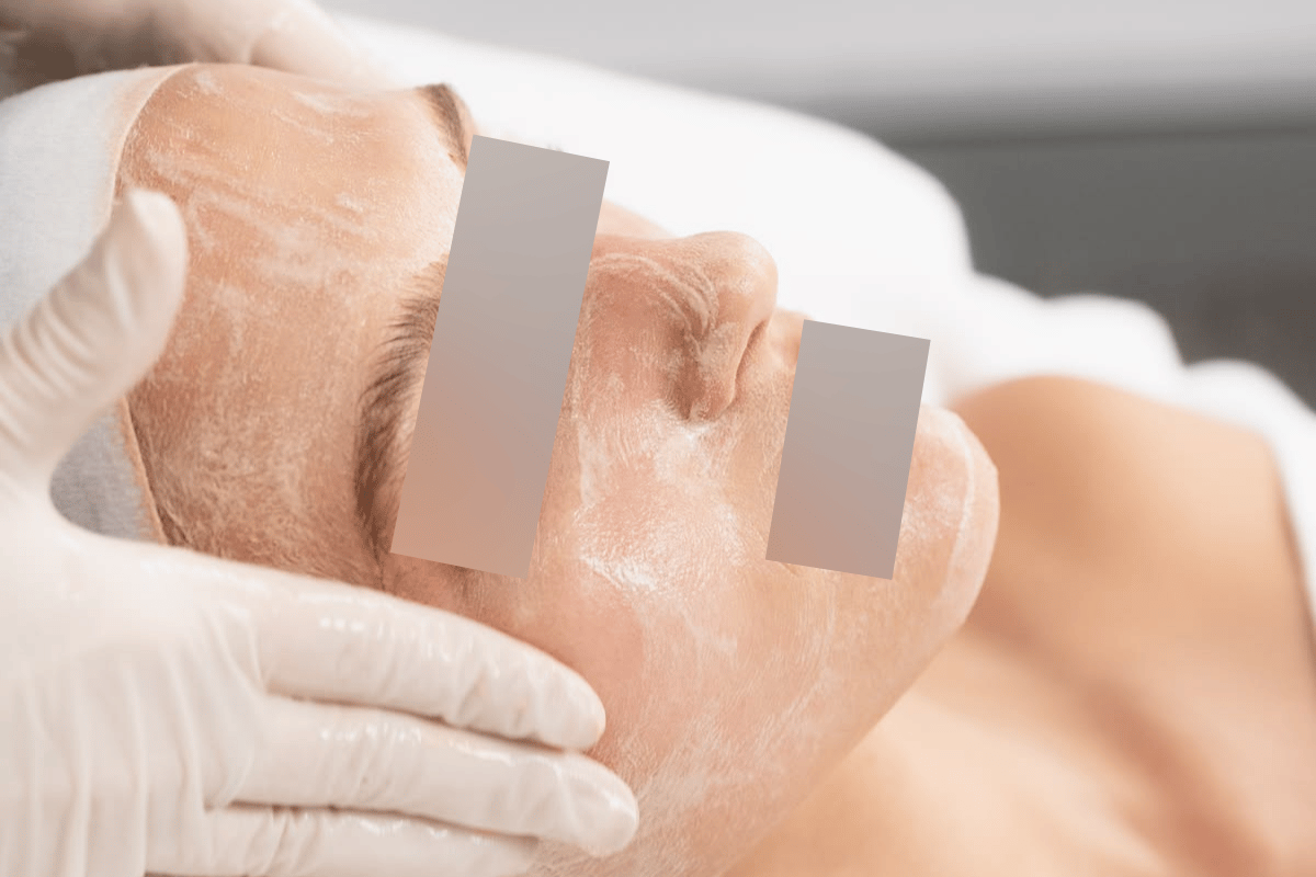 Anti Aging Peeling Face / Neck