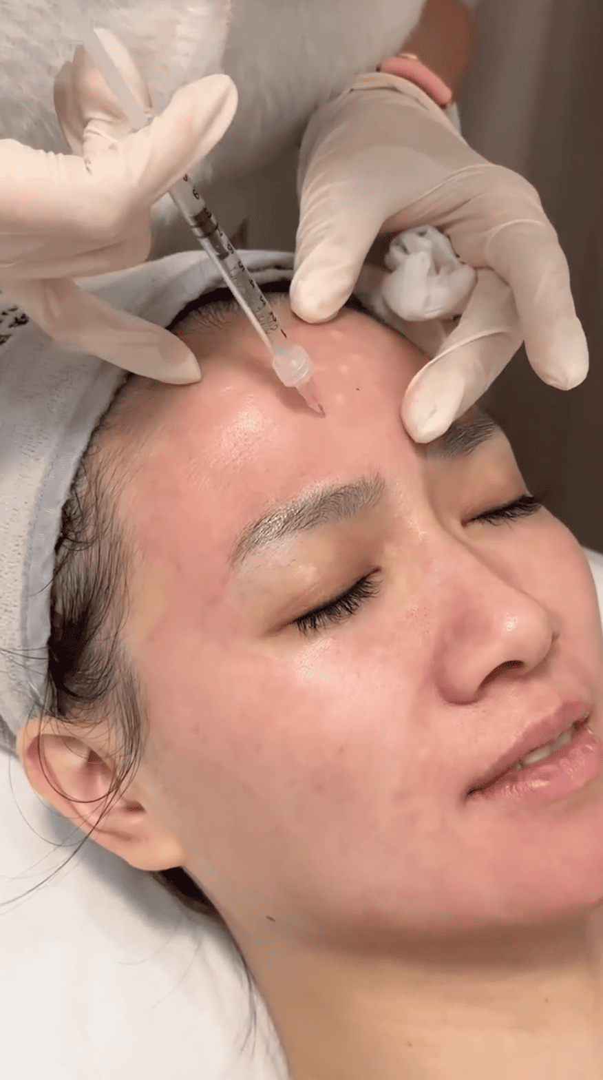 Botox Korea