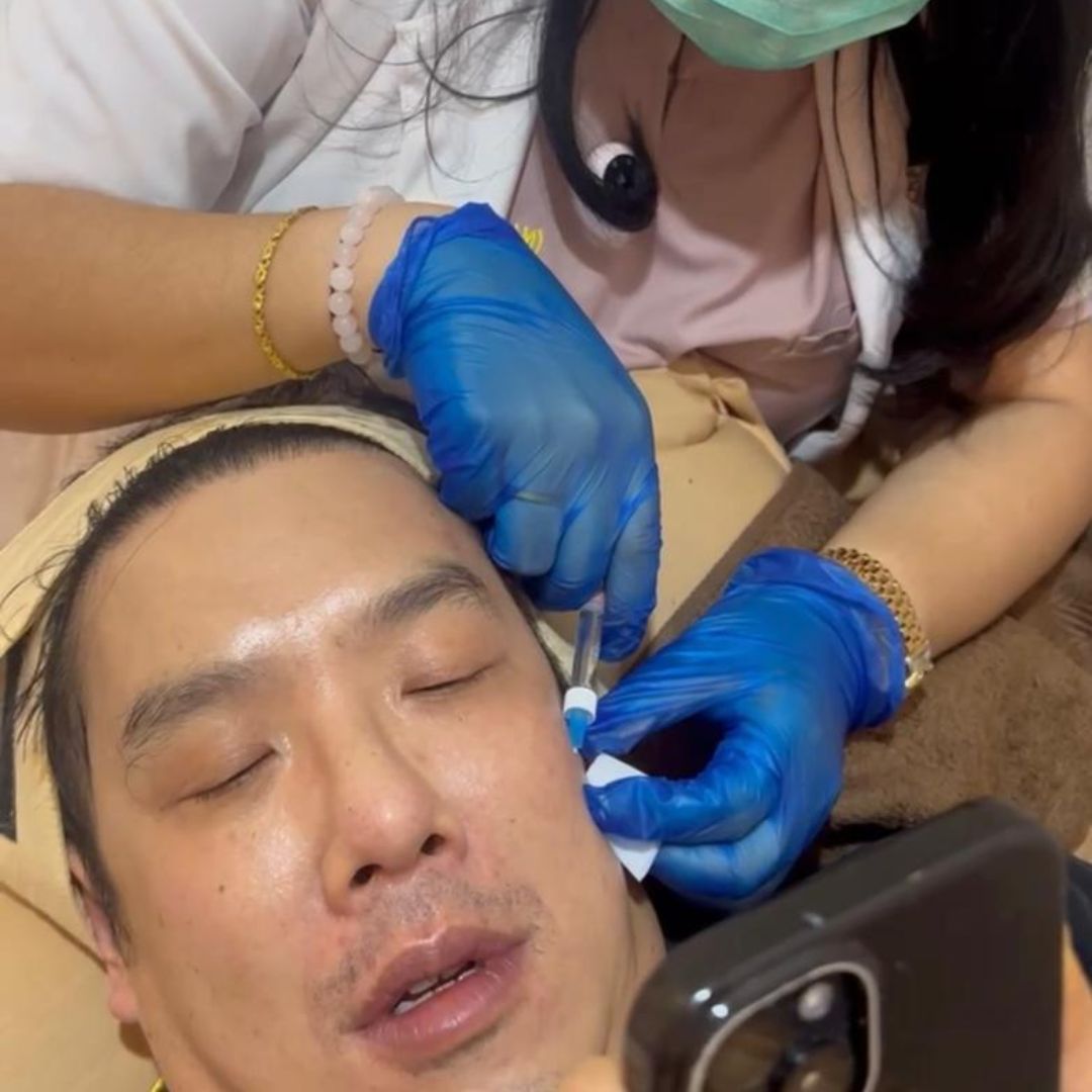 Derma Renewal Stemcell