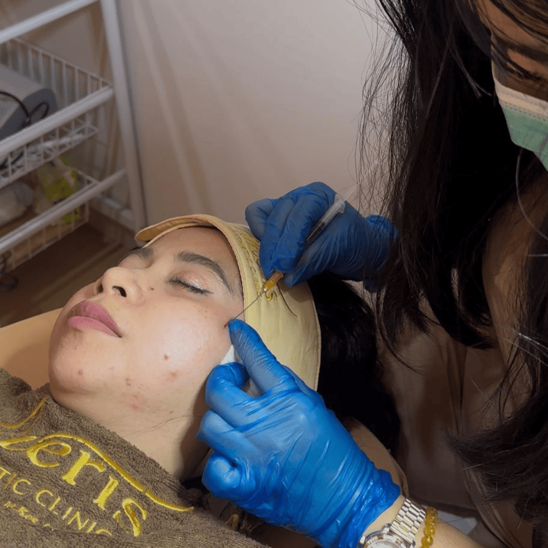 Derma Acne Scar Repair