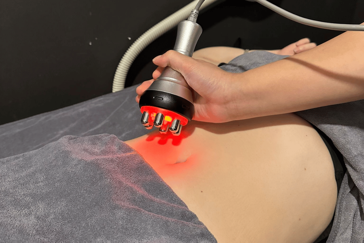 RF Abdomen / Perut