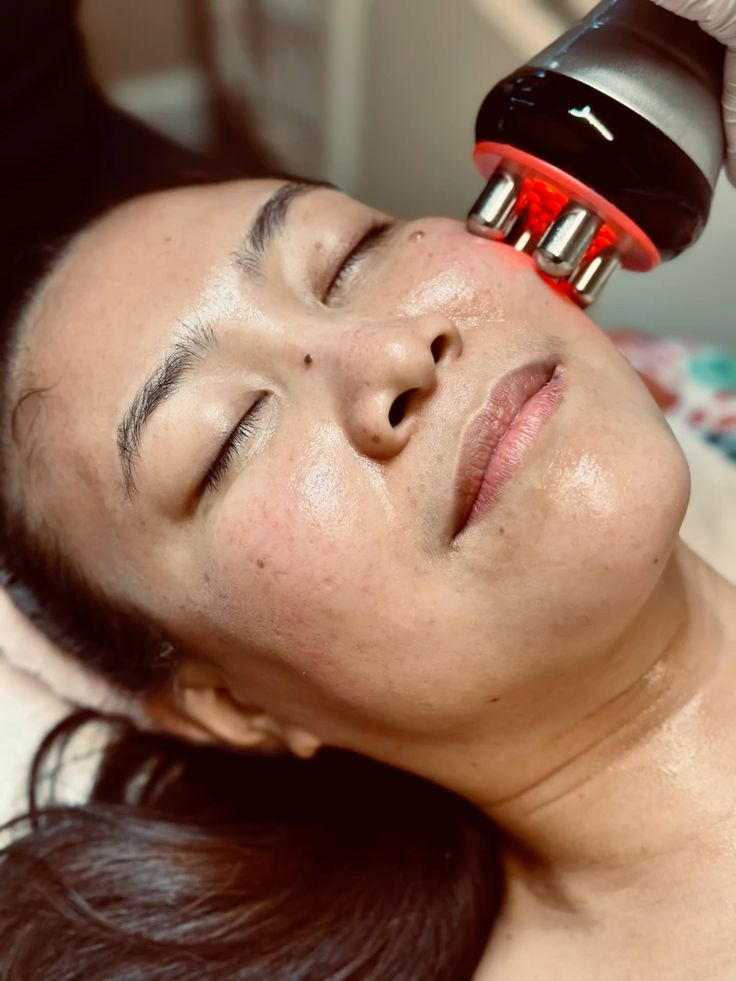 RF Face & Neck